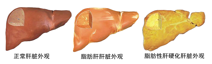2014110311362178.png